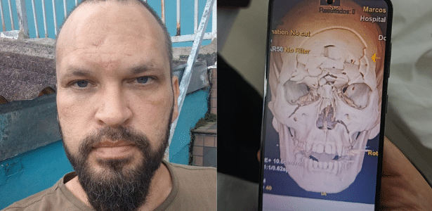 motociclista-tem-cranio-‘triturado’-em-acidente-no-pr:-‘tipo-quebra-cabeca’