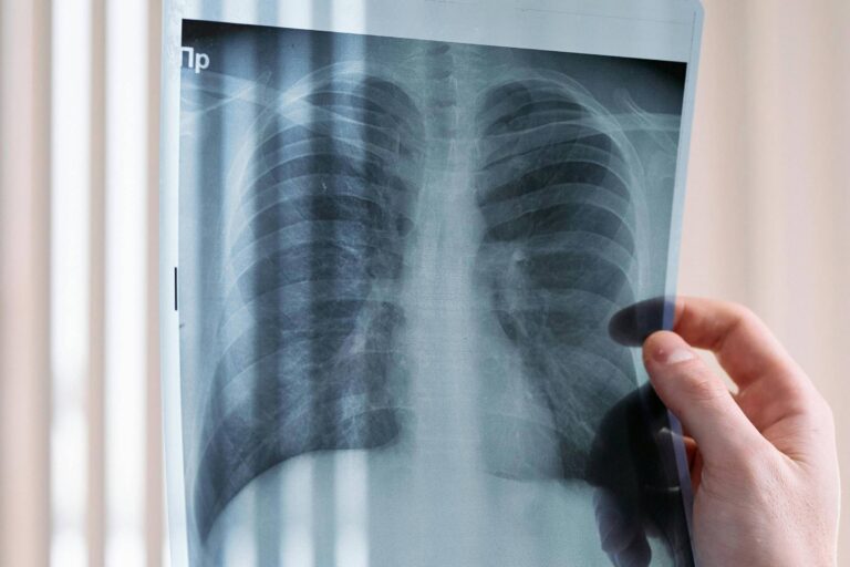 biopsia-liquida-avanca-como-ferramenta-para-detectar-mutacoes-em-cancer-de-pulmao