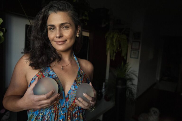 mais-mulheres-fazem-explante-de-silicone-e-valorizam-seios-pequenos